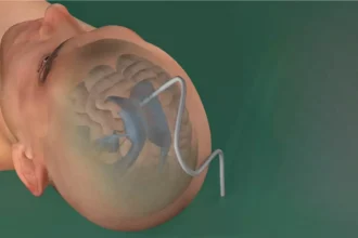 Rhovica Neuroimaging SoNav solution